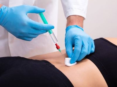 Comprehensive Guide to Spinal Injections