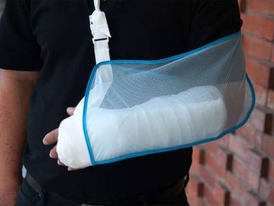 The Importance of Rest in Recovering from Arm Injuries