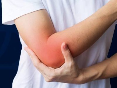 Tips for Reducing Arm Swelling After an Injury