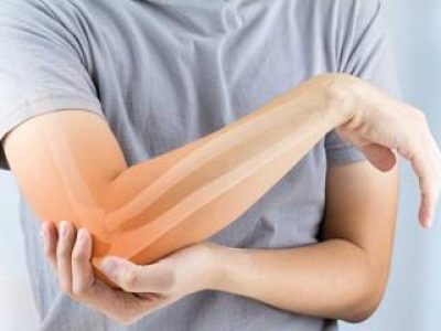 Understanding and Treating Arm Sprains