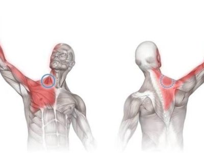 How to Manage Arm Pain from Repetitive Motion