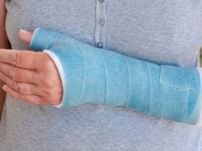 How to Choose the Right Brace for Your Arm Injury: A Comprehensive Guide