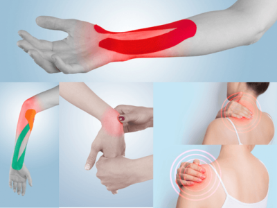 The Impact of Repetitive Strain Injuries on Arm Health