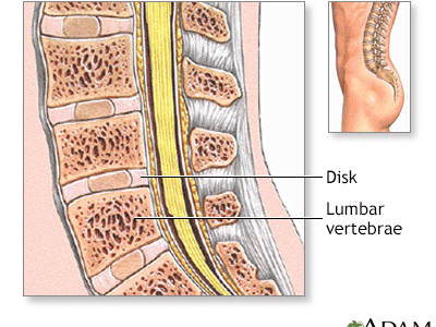 Bone Grafts in Spine Surgery