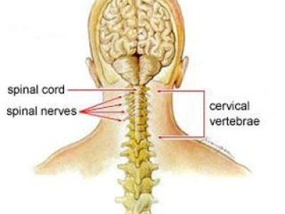 Understanding Neck Pain: Causes, Vulnerabilities, and Treatment Options