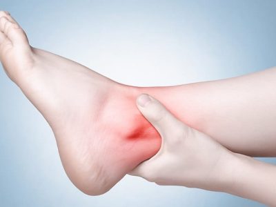 Arthritis of the Foot and Ankle