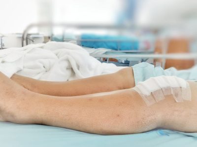 What’s the Best Way To Sleep After Meniscus Surgery?