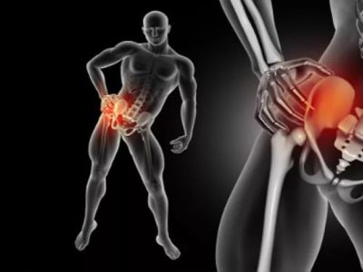 Treatment of bursitis when feeling hip and thigh pain