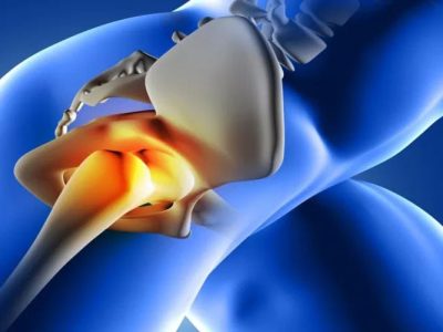 The negative aspects of having two joints