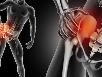 Optimizing Bone Grafts for Successful Spinal Fusion Surgery