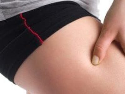 Understanding Meralgia Paresthetica: Causes, Symptoms, and Treatment for Burning Thigh Pain